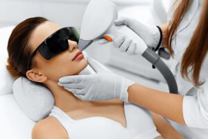 Depilación Láser del labio superior femenino