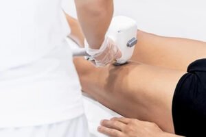 depilación láser piernas hombre