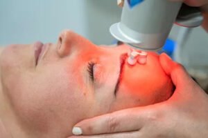 tratamiento facial bellaction